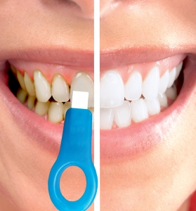 Dental Ultra Cleaner Pack